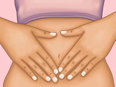 FODMAP